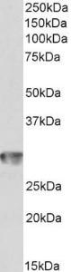 Anti-CD4 Antibody (A82715) (1 µg/ml) staining of Human Spleen lysate (35 µg protein in RIPA buffer). Primary incubation was 1 hour. Detected by chemiluminescence