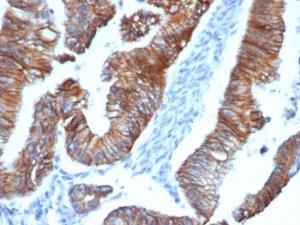 Immunohistochemical analysis of formalin-fixed, paraffin-embedded human colon using Anti-delta 1 Catenin Antibody [CTNND1/4383R] at 2 µg/ml in PBS for 30  minutes at room temperature