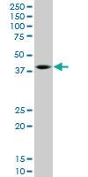 Anti-SPP1 Mouse Monoclonal Antibody [clone: 3E11]