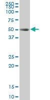 Anti-HNF1B Mouse Monoclonal Antibody [clone: 3E11]