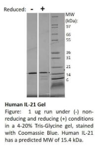 Human recombinant IL-21 (from<i>E. coli</i>)