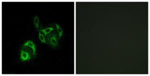 Immunofluorescence analysis of A549 cells using Anti-SLC27A4 Antibody. The right hand panel represents a negative control, where the antibody was pre-incubated with the immunising peptide.