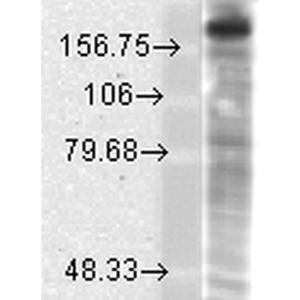 Anti-NMDAR2B antibody