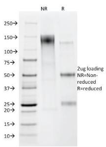 SDS-PAGE analysis of Anti-Helicobacter pylori Antibody [HP/212] under non-reduced and reduced conditions; showing intact IgG and intact heavy and light chains, respectively. SDS-PAGE analysis confirms the integrity and purity of the antibody