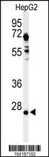 Anti-UCHL3 Rabbit Polyclonal Antibody