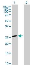 Anti-TK1 Rabbit Polyclonal Antibody