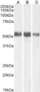 Anti-ALPL Antibody (A82716) (0.1 µg/ml) staining of Human Kidney (A), Lung (B) and Adrenal Gland (C) lysates (35 µg protein in RIPA buffer). Primary incubation was 1 hour. Detected by chemiluminescence