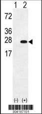 Anti-UCHL3 Rabbit Polyclonal Antibody