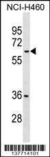 Anti-MDH1B Rabbit Polyclonal Antibody (PE (Phycoerythrin))