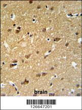 Anti-EMC10 Rabbit Polyclonal Antibody (FITC (Fluorescein Isothiocyanate))