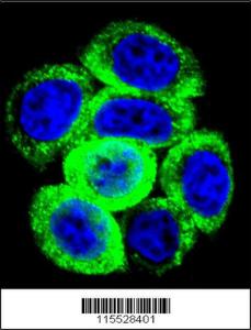 Anti-PRL Rabbit Polyclonal Antibody (HRP (Horseradish Peroxidase))