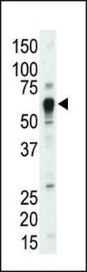 Anti-TEC Rabbit Polyclonal Antibody (AP (Alkaline Phosphatase))