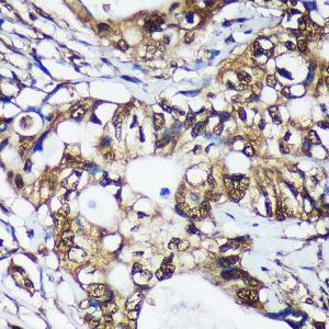 Anti-Translin/TSN antibody