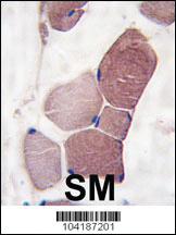 Anti-UCHL3 Rabbit Polyclonal Antibody