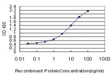 Anti-SPP1 Mouse Monoclonal Antibody [clone: 3E11]