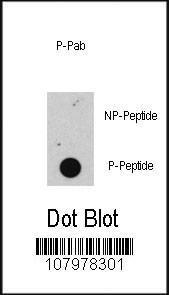 Anti-RB1 Rabbit Polyclonal Antibody