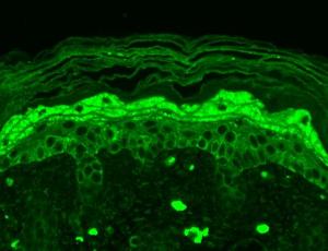 Anti-NMDAR2B antibody