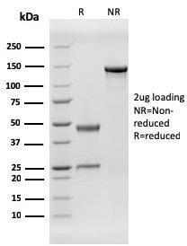 SDS-PAGE analysis of Anti-HHV8 LNA-1 Antibody [HHV8/3606] under non-reduced and reduced conditions; showing intact IgG and intact heavy and light chains, respectively. SDS-PAGE analysis confirms the integrity and purity of the antibody