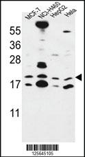 Anti-CNPY2 Rabbit Polyclonal Antibody [clone: 366CT28.2.3]