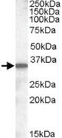 Anti-SLC10A2 Goat Polyclonal Antibody