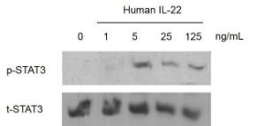 Human recombinant IL-22 (from <i>E. coli</i>)