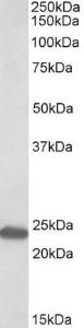 Anti-GM2A antibody