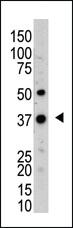 Anti-UCHL5 Rabbit Polyclonal Antibody