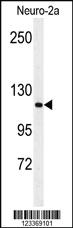 Anti-RERE Rabbit Polyclonal Antibody