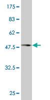 Anti-DCTN1 Mouse Monoclonal Antibody [clone: 1E12]