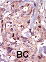 Anti-TEC Rabbit Polyclonal Antibody (AP (Alkaline Phosphatase))