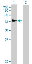 Anti-NDUFS1 Mouse Polyclonal Antibody