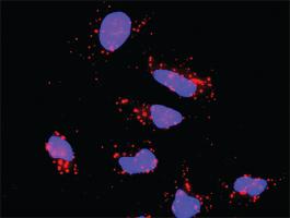 Anti-AKT1 + PIAS2 Antibody Pair