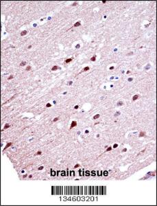 Anti-KCND2 Rabbit Polyclonal Antibody (HRP (Horseradish Peroxidase))