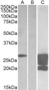 Anti-GM2A antibody