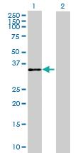 Anti-AKR1B10 Mouse Polyclonal Antibody