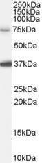 Anti-NEDD1 Antibody (A84279) (01 µg/ml) staining of HeLa cell lysate (35 µg protein in RIPA buffer) Primary incubation was 1 hour Detected by chemiluminescence