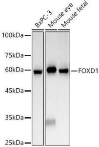 Western blot analysis of various lysates, using Anti-FOXD1 / BF-2 Antibody (A309886) at 1:1000 dilution