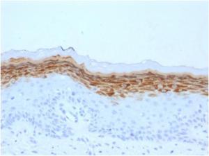 Immunohistochemical analysis of formalin-fixed, paraffin-embedded human skin using Anti-Filaggrin Antibody [FLG/1561]