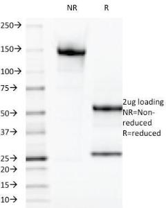 SDS-PAGE analysis of Anti-Galectin 13 Antibody [PP13/1165] under non-reduced and reduced conditions; showing intact IgG and intact heavy and light chains, respectively SDS-PAGE analysis confirms the integrity and purity of the antibody