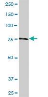 Anti-NDUFS1 Mouse Polyclonal Antibody