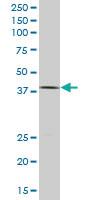 Anti-HNF1B Mouse Monoclonal Antibody [clone: 4E9]