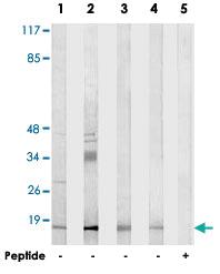 Anti-NDUFA4L2 Rabbit Polyclonal Antibody