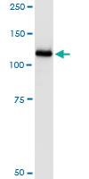 Anti-UBA7 Polyclonal Antibody Pair