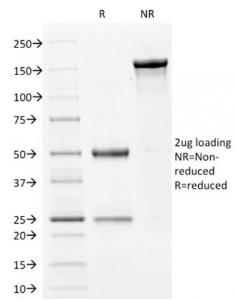 SDS-PAGE analysis of Anti-Filaggrin Antibody [FLG/1561] under non-reduced and reduced conditions; showing intact IgG and intact heavy and light chains, respectively. SDS-PAGE analysis confirms the integrity and purity of the antibody.