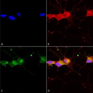 Anti-NMDAR2B antibody