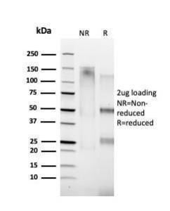 SDS-PAGE analysis of Anti-Cyclin A1 Antibody [XLA1-1] under non-reduced and reduced conditions; showing intact IgG and intact heavy and light chains, respectively. SDS-PAGE analysis confirms the integrity and purity of the antibody