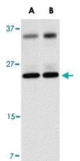 Anti-THEM4 Rabbit Polyclonal Antibody