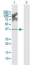 Anti-AKR1B10 Rabbit Polyclonal Antibody