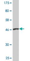 Anti-DCTN1 Mouse Monoclonal Antibody [clone: 2E4-1C2]