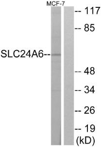 Anti-SLC24A6 Rabbit Polyclonal Antibody